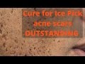 How to treat ice pick acne scars