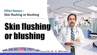 Skin flushing or blushing : Causes, Diagnosis, Symptoms, Treatment, Prognosis