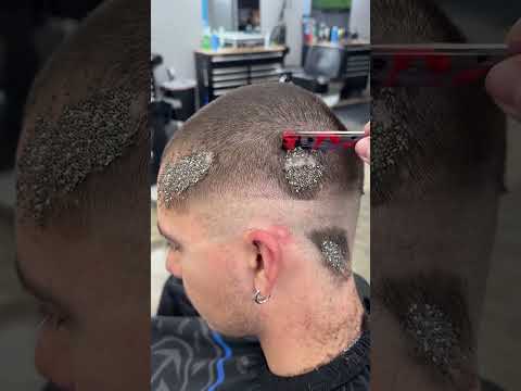 This Hairdresser Must Save His Client From Lice!✂️
