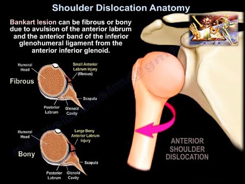 Anatomía de la luxación de hombro - Todo lo que se necesita saber