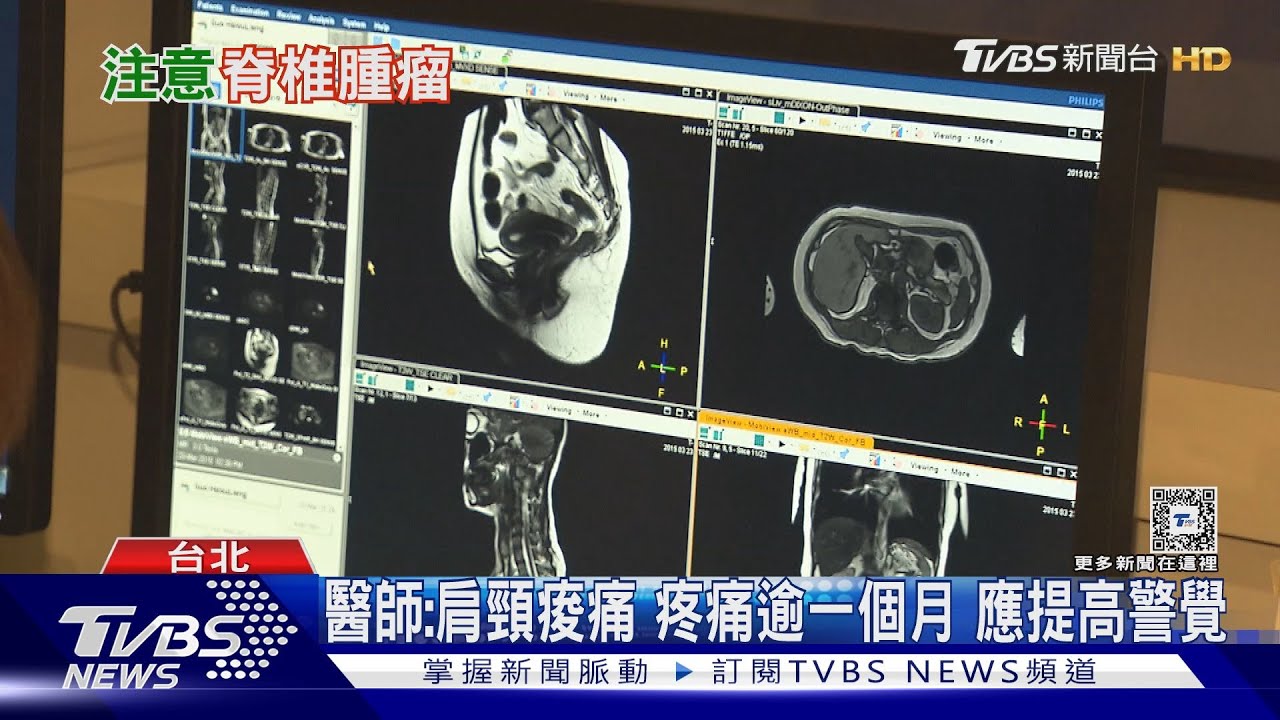 輕忽「這部位」疼痛 醫:恐腫瘤作祟 做「這事」降死亡風險!