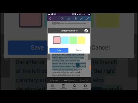 EKG Basics - Learning and inte Video