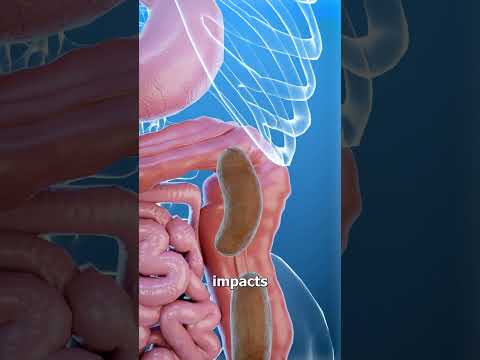 What Is Constipation? 💩