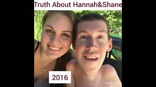 Squirmy and Grubs .Truth of Hannah Burcaw .# Love Life #awarness