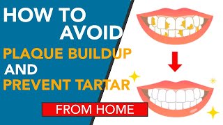 How To Avoid Plaque Buildup And Prevent Tartar