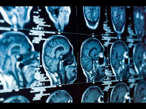 Audio: The endocannabinoid's synergistic harm reduction effects of Cannabis & opiates Senate, C-45