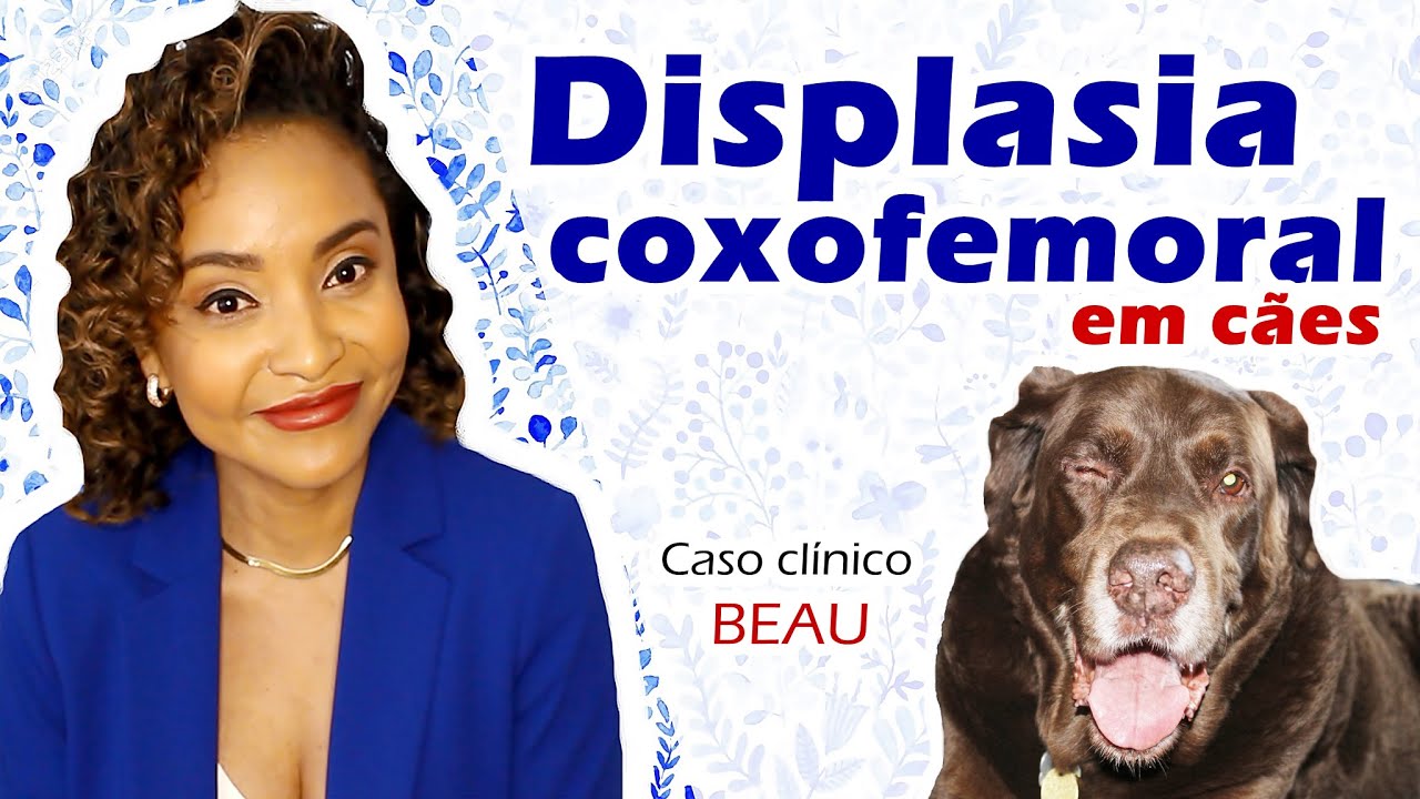 #DISPLASIA #COXOFEMORAL. CASO CLÍNICO - BEAU.