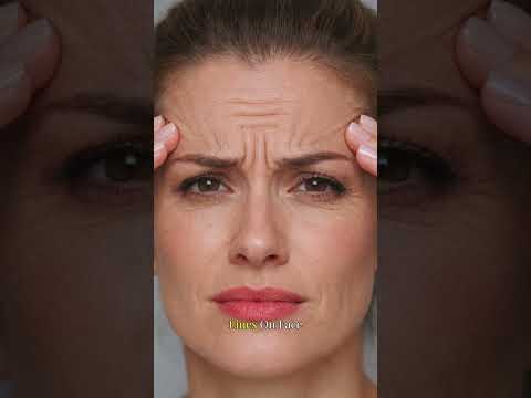Old Acne Scars Treatment with Fractional CO₂ (FG) Laser |  Explains | Cosmo Radiance Hyderabad