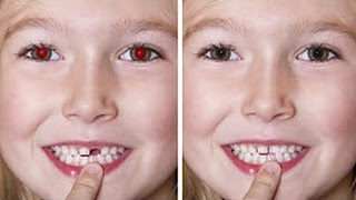 How to Remove Red Eyes in Photoshop