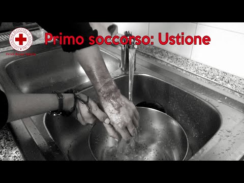 Primo soccorso: Ustione - Comitato Locale CRI Bardolino Baldo Garda