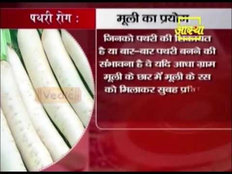 Natural Methods to cure Kidney Stone   Acharya balkrishna