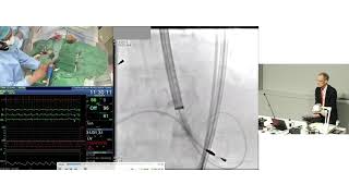 Transfemoral TAVI Live Case-in-a-Box – Royal North Shore Hospital