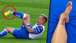Scariest Moments In Football