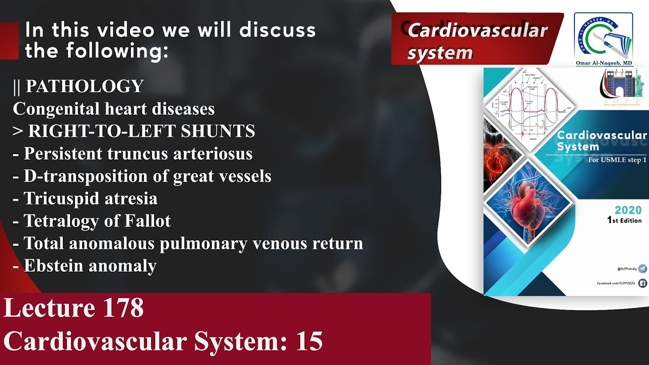 Persistent truncus arteriosus | Tricuspid atresia | Tetralogy of Fallot | Ebstein anomaly