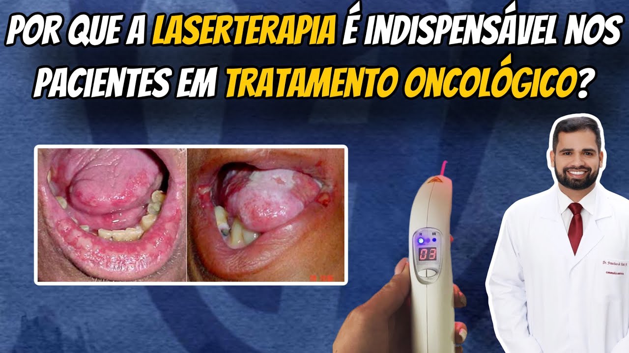 Francisco De Assis Almeida Lima Júnior-39