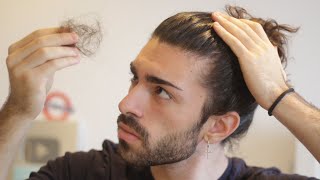 How Much Hair Loss Per Day Is Normal?
