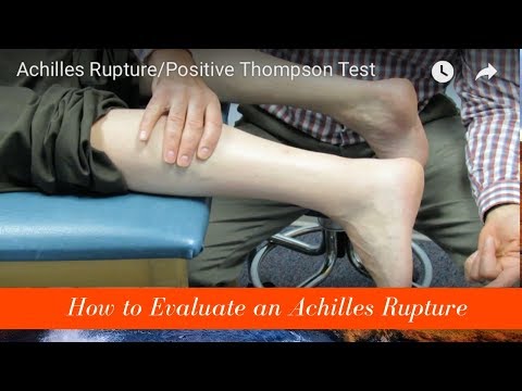 Metatarsalgia and Morton s Neuroma Evaluation and Treatment