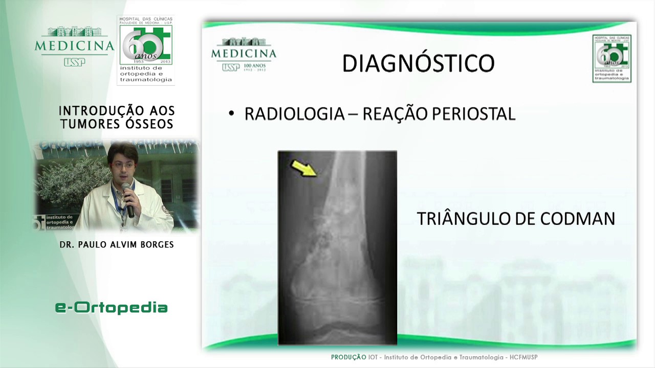Introdução aos Tumores Ósseos - Dr. Paulo Alvim