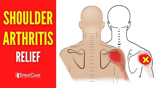 How to Relieve Shoulder Arthritis Pain in 30 SECONDS
