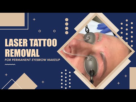 download lagu mp3 mp4 Permanent Eyebrow Removal, download lagu Permanent Eyebrow Removal gratis, unduh video klip Permanent Eyebrow Removal