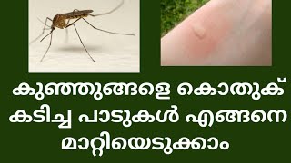 How to treat mosquito scar/malayalam