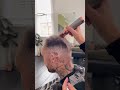 Hairline Tattoo Hair Loss Transformation SMP Melbourne