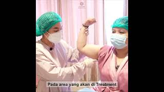 Download lagu Fat Dissolving Injection Lengan mp3