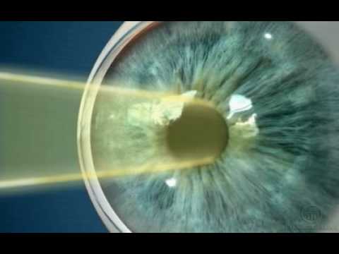 Anatomia do olho - Pupila