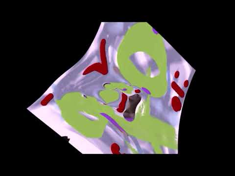 Schrunzel - Endschprampf