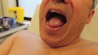 How to look for central cyanosis