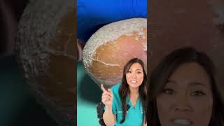 Are you carving a turkey or dry, cracked heels today 👀🦃