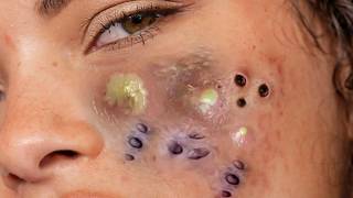 𝑅𝑒𝑐𝑙𝑎𝑖𝑚 𝑌𝑜𝑢𝑟 𝐺𝑙𝑜𝑤 𝐴𝑛𝑑 𝐶𝑎𝑙𝑚 𝑇ℎ𝑟𝑜𝑢𝑔ℎ 𝑀𝑖𝑛𝑑𝑓𝑢𝑙 𝑆𝑘𝑖𝑛𝑐𝑎𝑟𝑒 𝑀𝑜𝑚𝑒𝑛𝑡𝑠 #656876