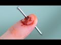 NAIL IN FINGER!