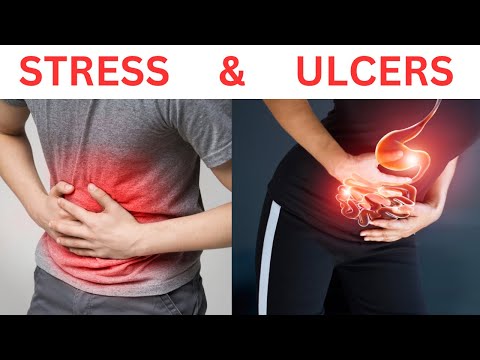 STRESS and STOMACH ULCERS: What’s the Connection?