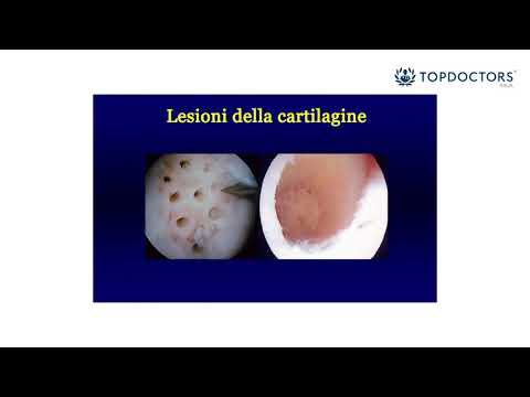 Yoga osteocondrosi toracica Se lombo malato in modo permanente
