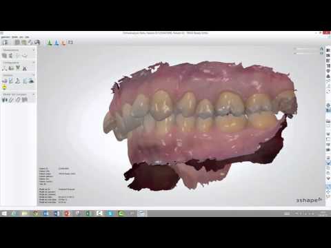 download lagu mp3 mp4 Ortho Analyzer, download lagu Ortho Analyzer gratis, unduh video klip Ortho Analyzer