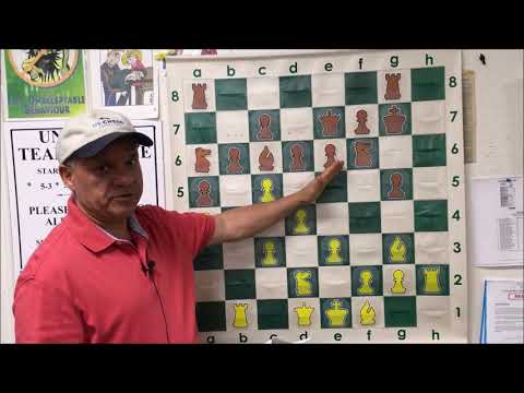 Kasparov's Ferocious Attack vs. Karpov's Staunch Defense | 1986 World Championship