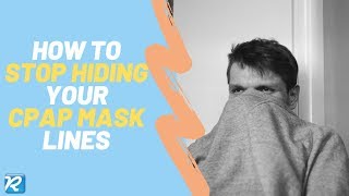 How to Remove CPAP Face Marks // Guide