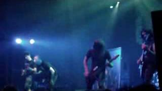 Download lagu Aborted ( 'Coronary Reconstruction' ) @ NDF 2010 mp3 Download lagu Aborted ( 'Coronary Reconstruction' ) @ NDF 2010 mp3