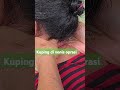 Mbah Maryono Ber Aksi Kuping Di Vonis Oprasi Shorts