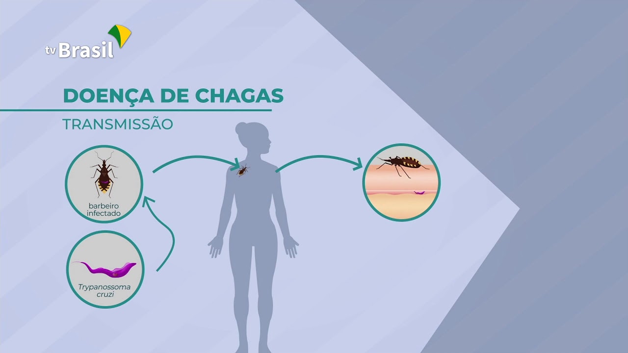 Fiocuz avança em pesquisa sobre  Doença de Chagas
