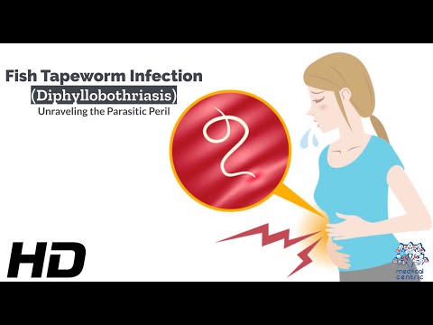 Effects of Cannabis on your body