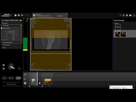 CT scan of wrist joint in siemens somatom go top 128 slice #ctscan #radiology #medicalimaging #wrist