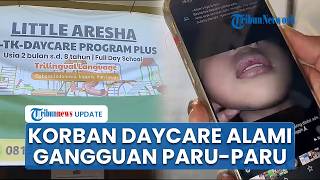 Diduga Jadi Korban Kekerasan Daycare di Yogya, Anak Noorman Alami Gangguan Paru-paru