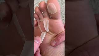 Some crazy results 🤪 #skincare #skin #health #amazon #amazonfinds #feet #life #natural #fyp