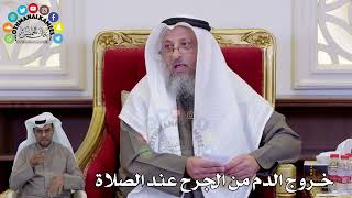 1459 - خروج الدم من الجرح عند الصلاة - عثمان الخميس