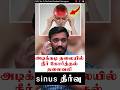 அடிக்கடி தலையில் நீர் கோர்த்தல் தலைவ