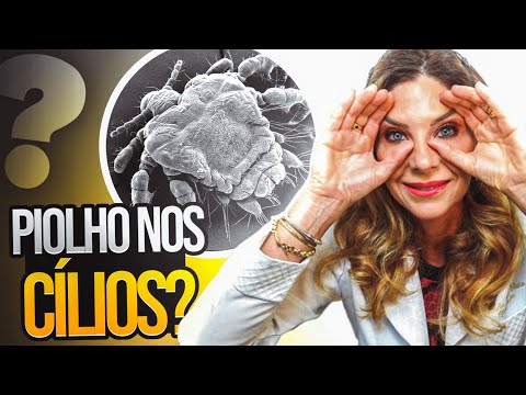 Itchy Eyes - What Causes Itchy Eyelashes?