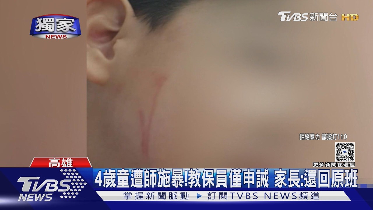 獨家影音／4歲童滿臉傷「全身近20處」！　教保員僅申誡、罰款　還要回原班