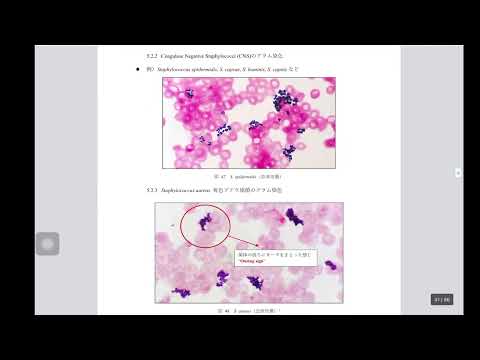看護学科 黄色ブドウ球菌とCNSをグラム染色で見分ける方法！
